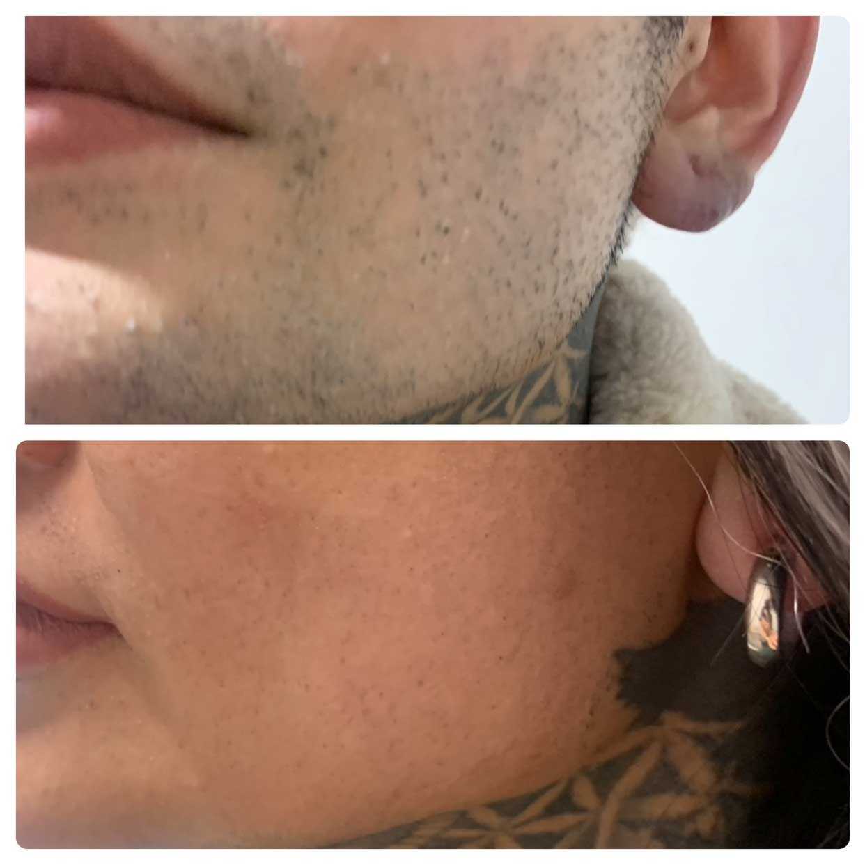 Before-After-01