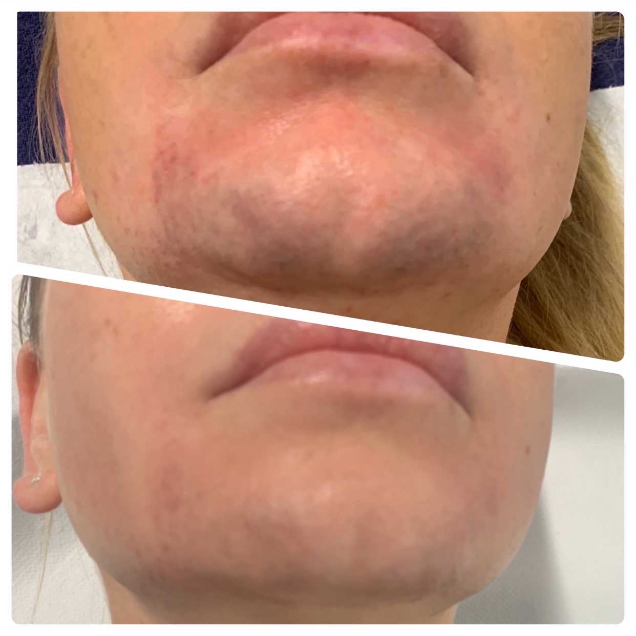 Before-After-02