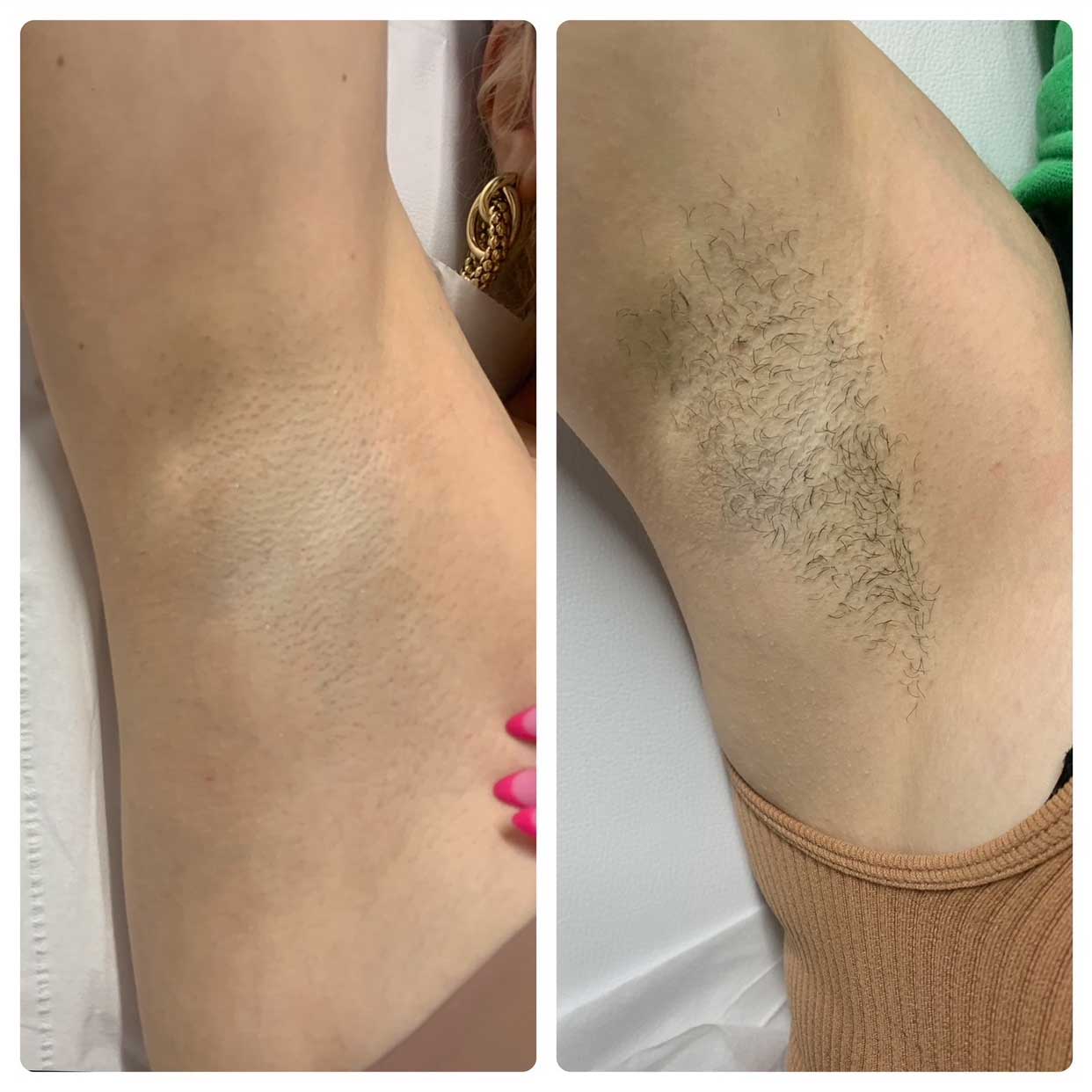 Before-After-03
