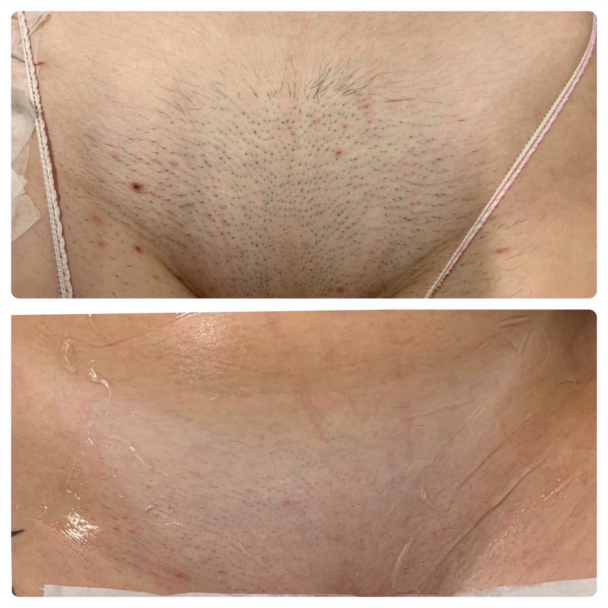 Before-After-04